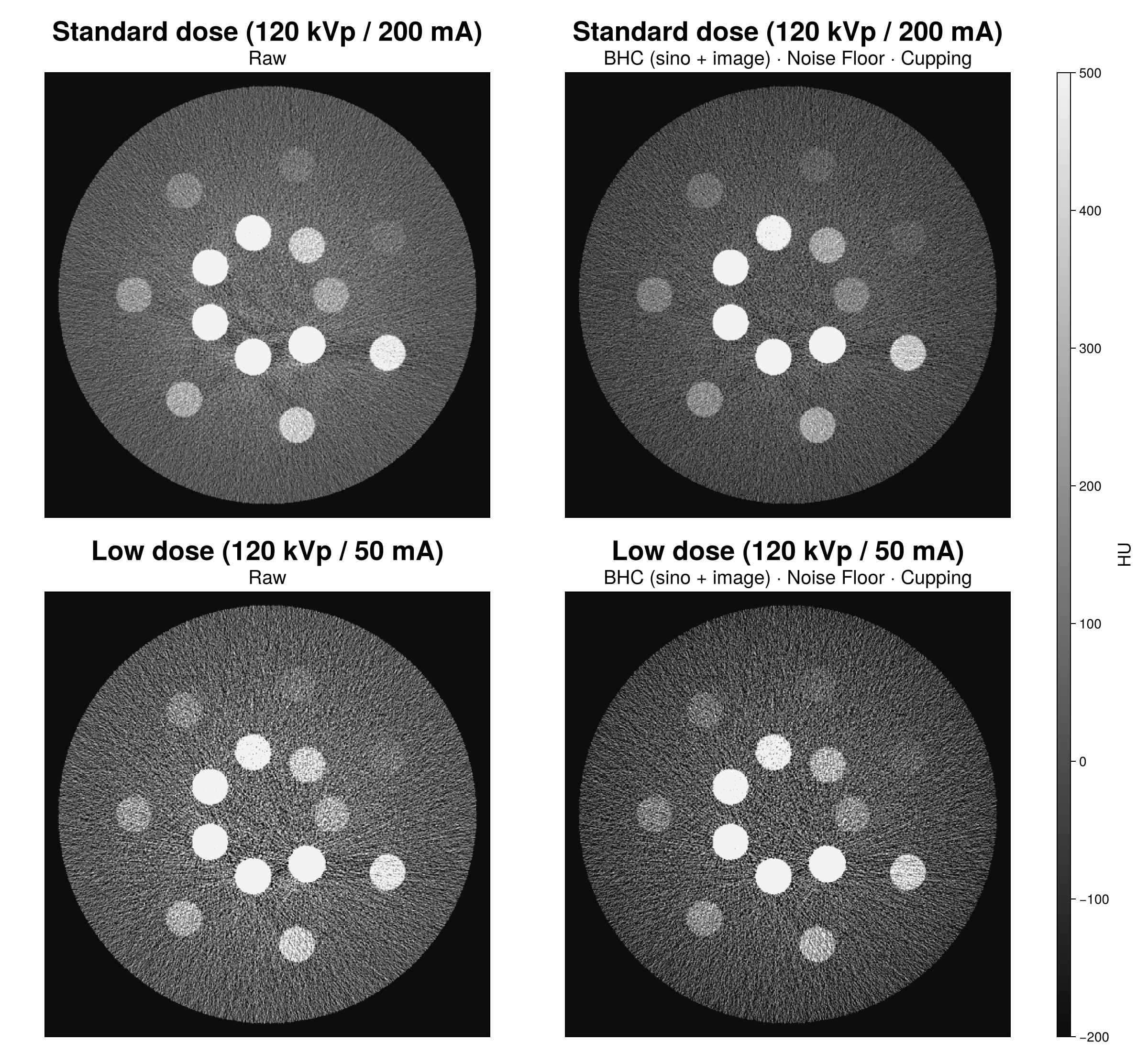 Standard vs low-dose reconstruction, raw vs corrected