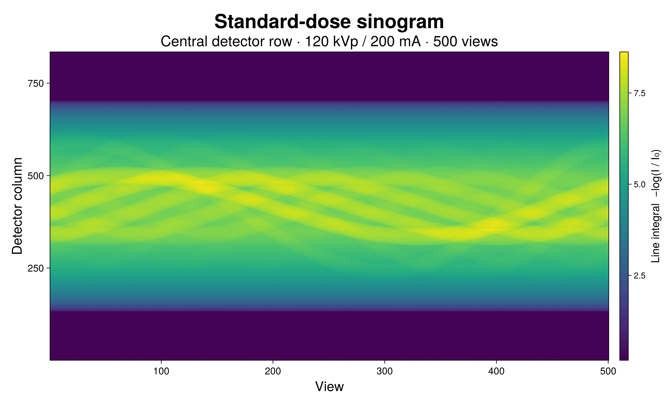 Standard-dose sinogram (central detector row)