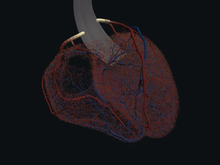 Heart: contrast through the grown coronary tree