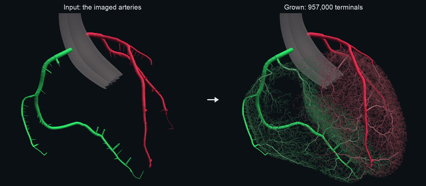The imaged coronary arteries and the tree grown from them
